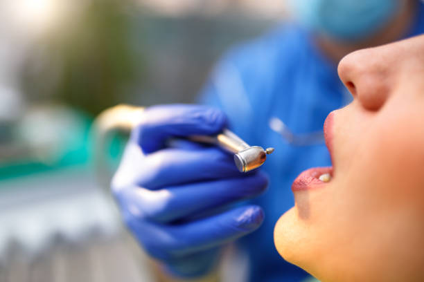Dental Inlays and Onlays in Camano, WA